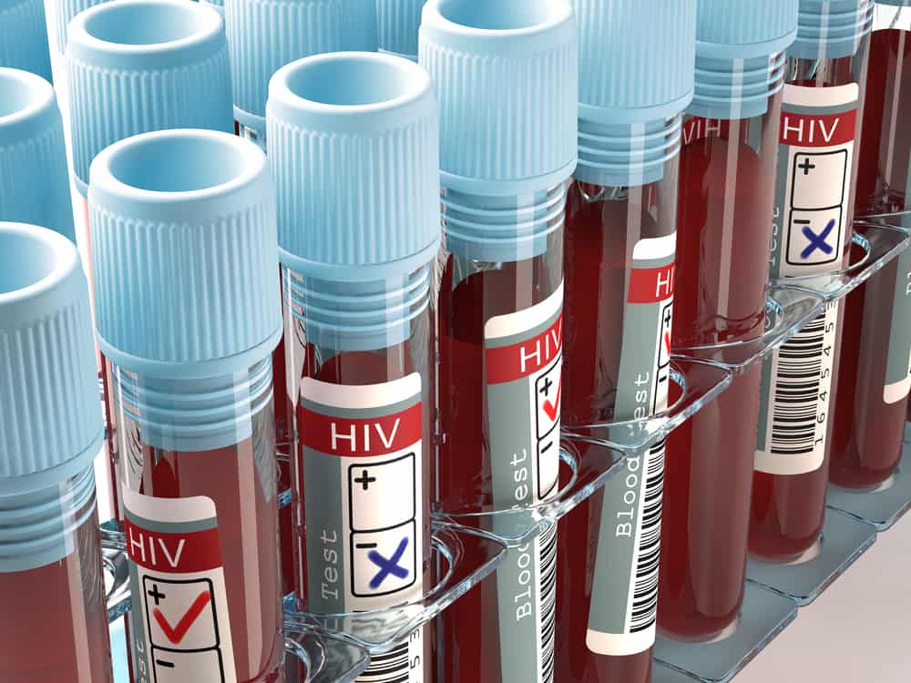 Inaspettatamente, questi sono 6 modi di trasmettere l'HIV di cui essere a conoscenza