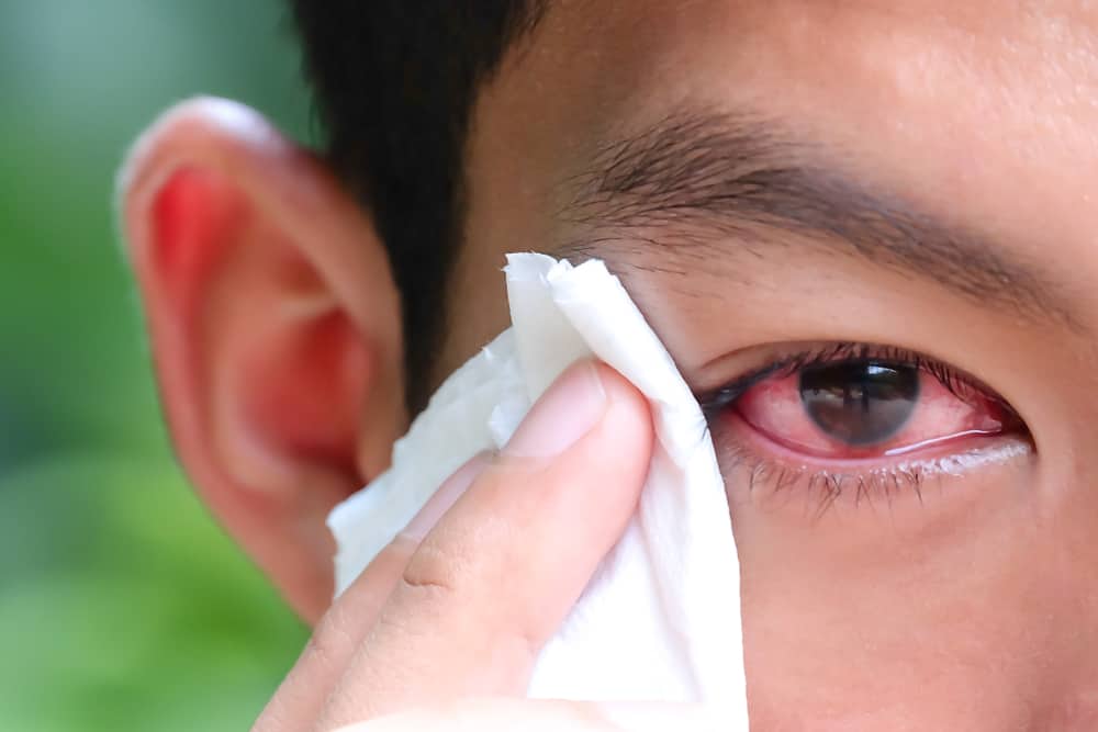 Bulaşıcı Göz Hastalıkları: Özelliklerini ve Nasıl Önleneceğini Bilin