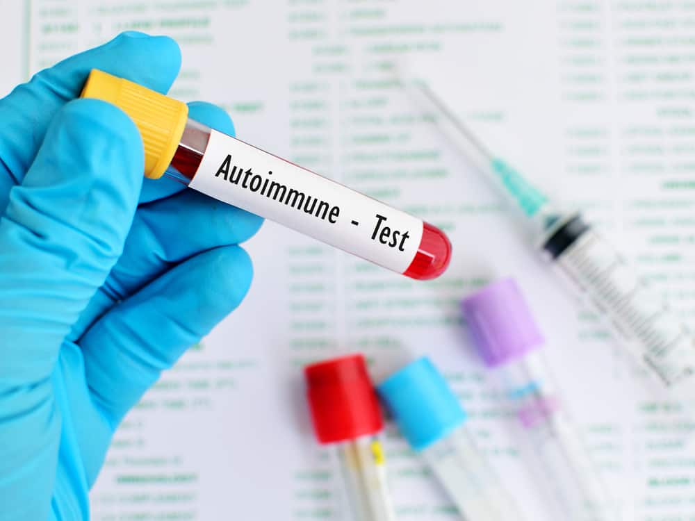 Разпознаване на автоимунни заболявания: причини, симптоми и лечение