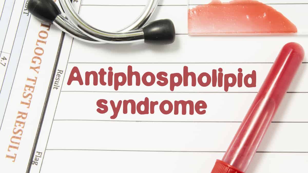 APS Syndrome คืออะไร? มารู้จักอาการของโรคเจสสิก้า อิสกันดาร์กันเถอะ