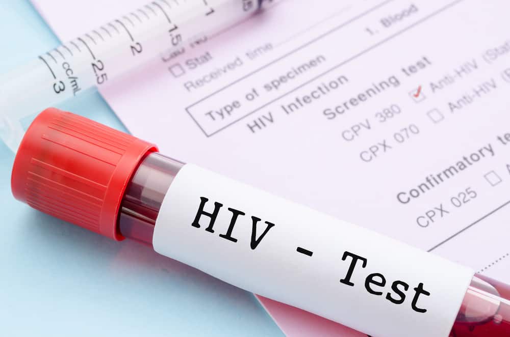 Bagaimana jangkitan HIV menjadi AIDS? Lihat Fakta Perubatan Di Bawah!