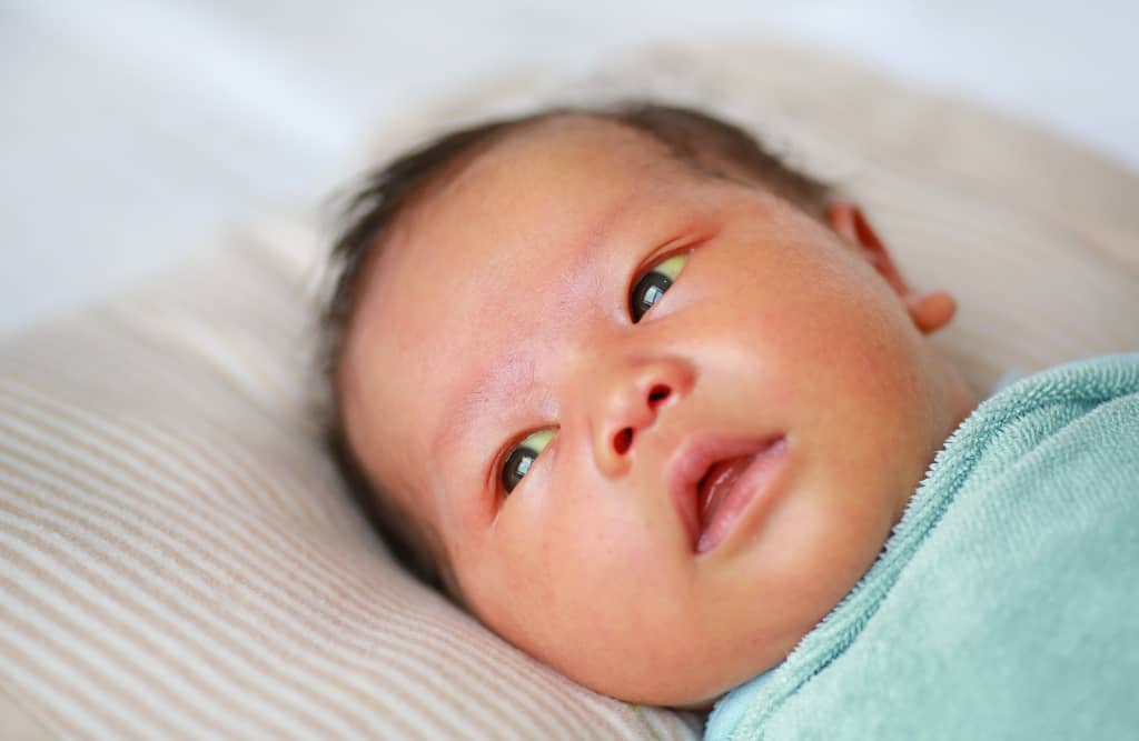 Често срещани при новородени, има различни причини за жълти бебета