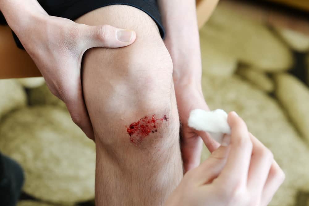 Ecco come trattare le ferite in modo che non lascino cicatrici sulla pelle