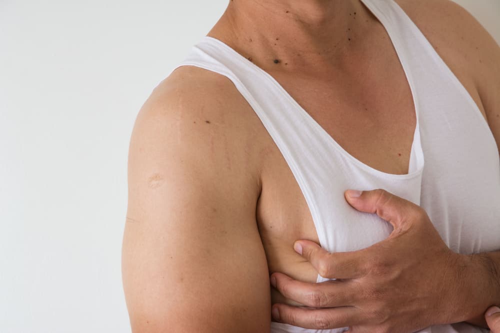 Conoscere la ginecomastia: la crescita del seno grande negli uomini