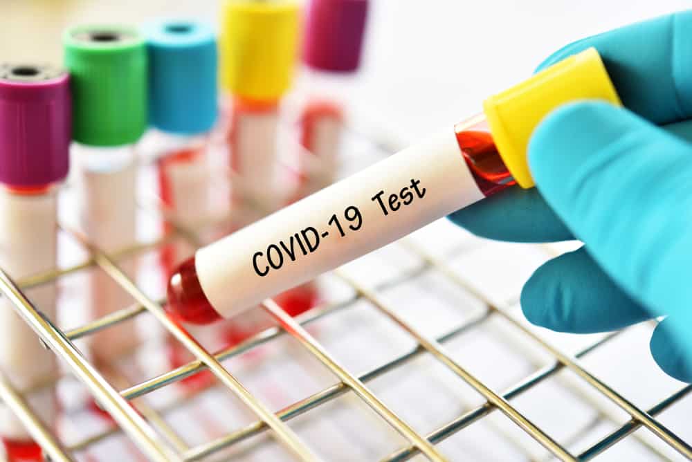 Conoscere i test sierologici di laboratorio per COVID-19