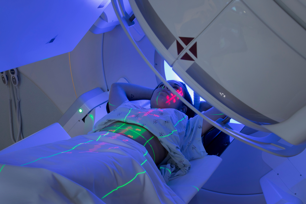 Radioterapia per il cancro, quali sono gli effetti collaterali da tenere d'occhio?
