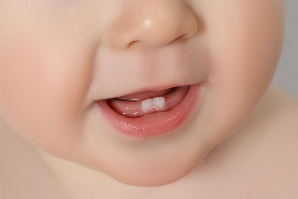 التعرف على أسنان عيد الميلاد: أسنان الأطفال حديثي الولادة
