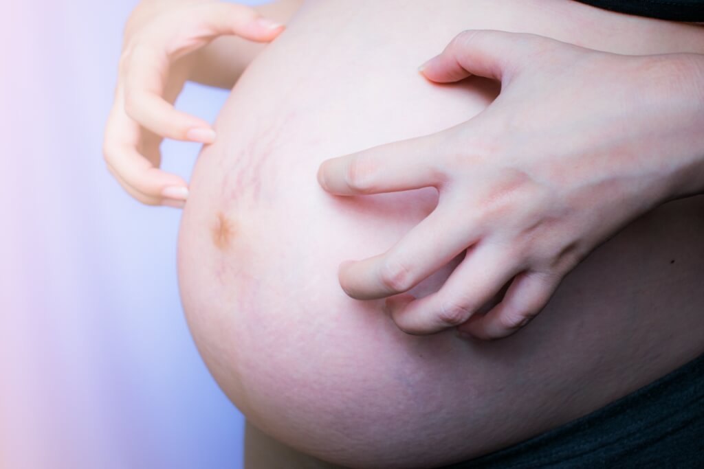 妊娠中のかゆみを伴う胃：原因とそれを克服する正しい方法