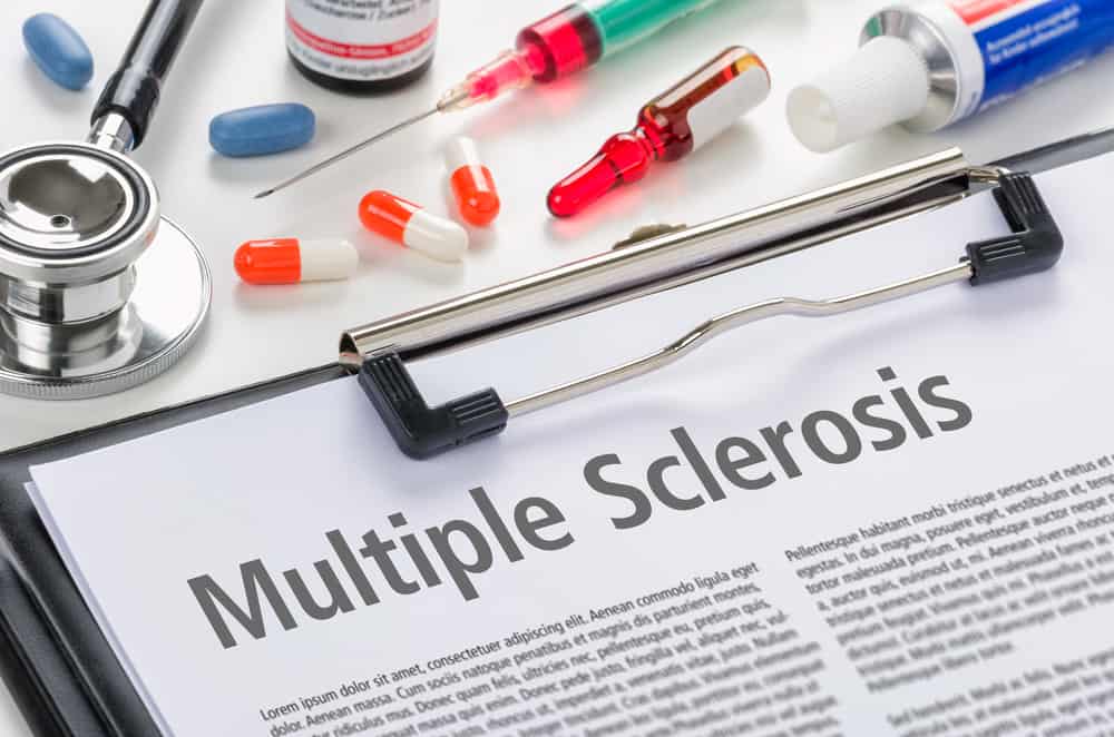 Berbahaya untuk Otak, Penyakit Multiple Sclerosis Anda Mesti Tahu Gejala, Punca dan Rawatan