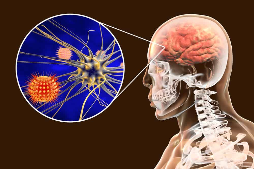 Attenzione all'encefalite giapponese, infiammazione del cervello dovuta a punture di zanzara