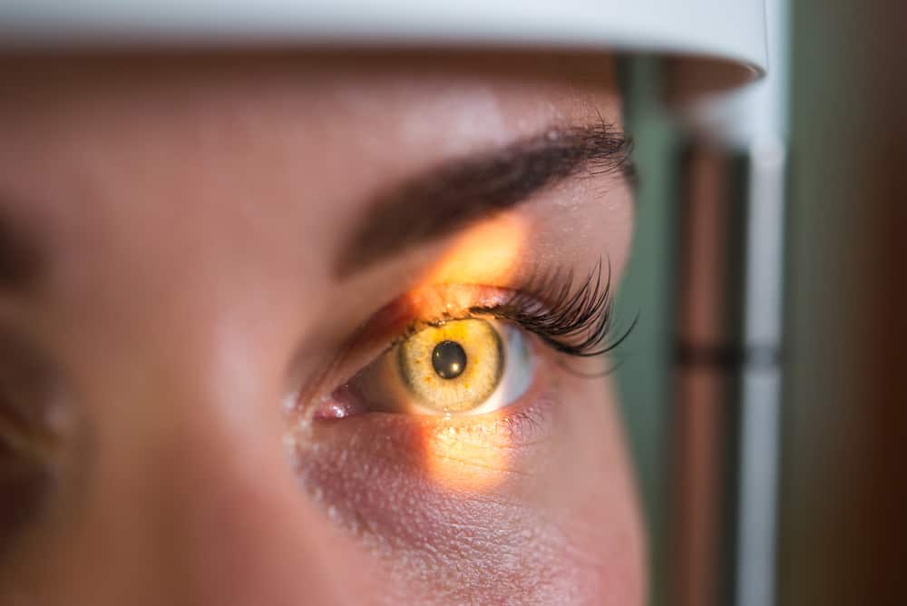 Boleh Membuat Buta, Ini Menyebabkan Glaukoma Mata