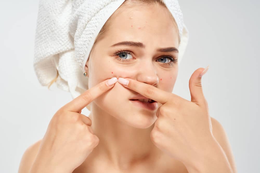 3 Fatti e miti Come sbarazzarsi dell'acne sul viso, lo sapevi?