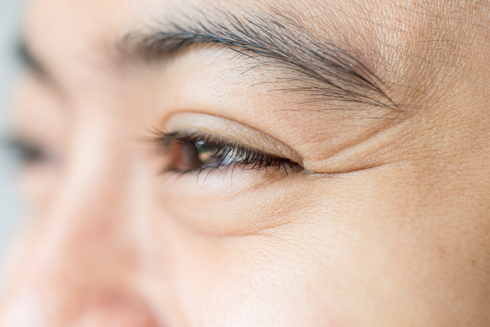 نصائح للتخلص من التجاعيد حول الشفاه والعين بشكل طبيعي
