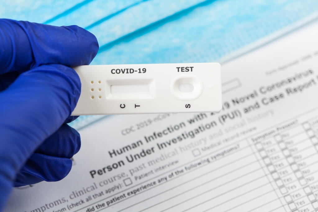 Apakah Perbezaan Antara Ujian Antibodi Kualitatif dan Ujian Antibodi Kuantitatif untuk COVID-19?