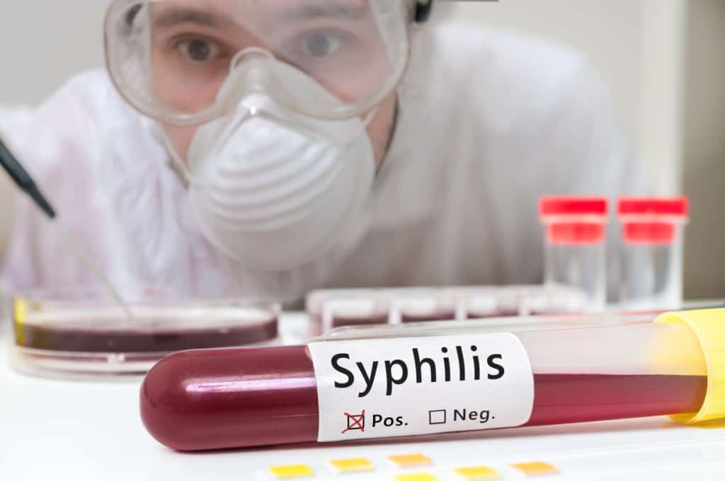Sifilide nelle donne: cause, sintomi e trattamenti comuni