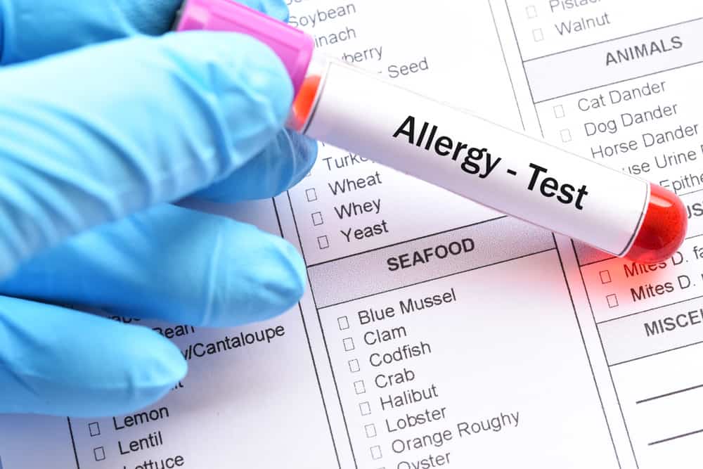 Алергиите към скариди могат да бъдат елиминирани? Открийте отговора тук
