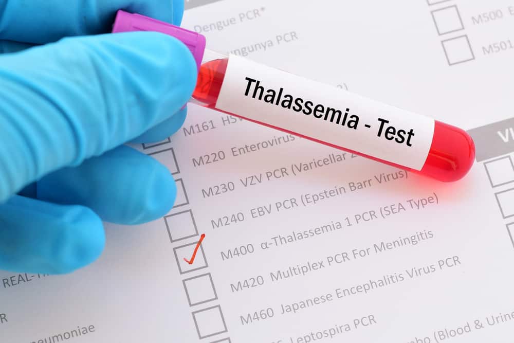التعرف على الثلاسيميا: اضطرابات الدم الناتجة عن عوامل وراثية