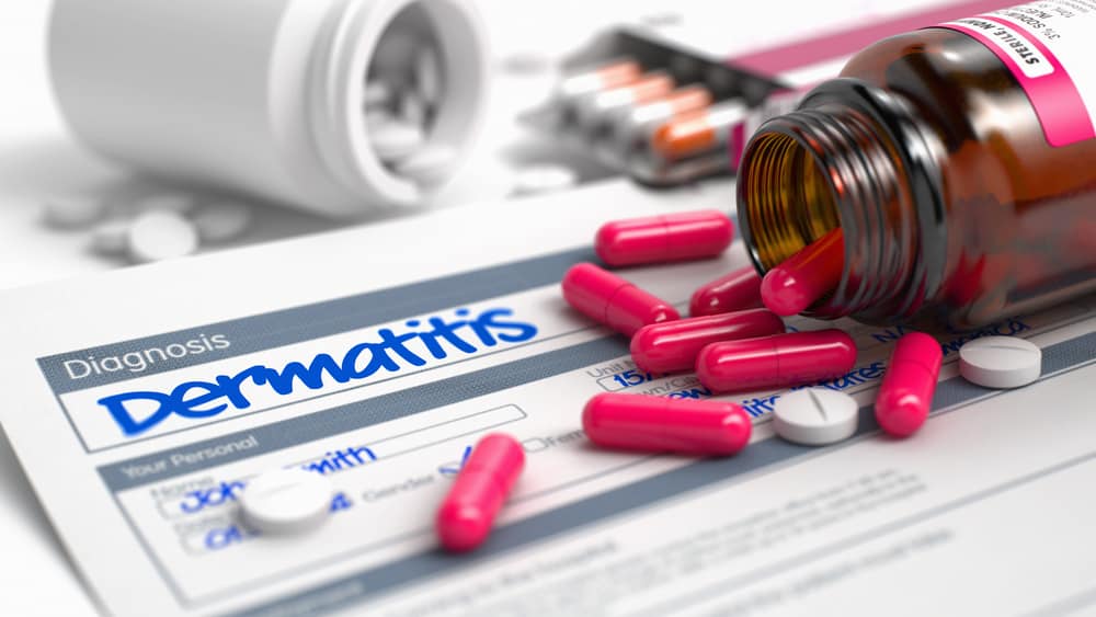 Искате ли мехлем или перорално, ето поредица от опции за лекарства за лечение на дерматит