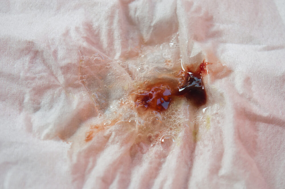 Причини за кървава слюнка, може ли да отбележи някои заболявания?