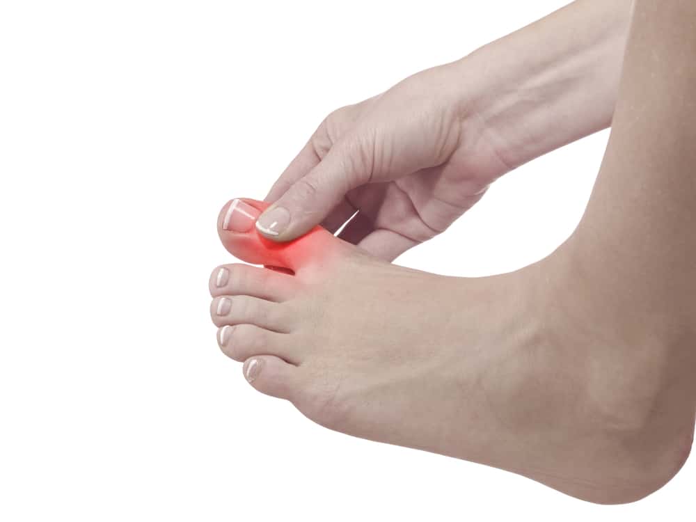 Sakit Sendi yang teruk dan benjolan di kaki, boleh menjadi gejala Gout!