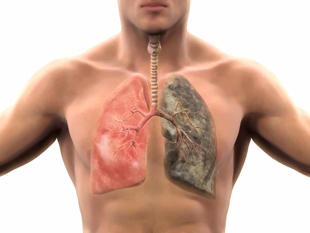 Pencemaran dan asap boleh menjadikan paru-paru kotor, mari kita lihat bagaimana membersihkan paru-paru di bawah
